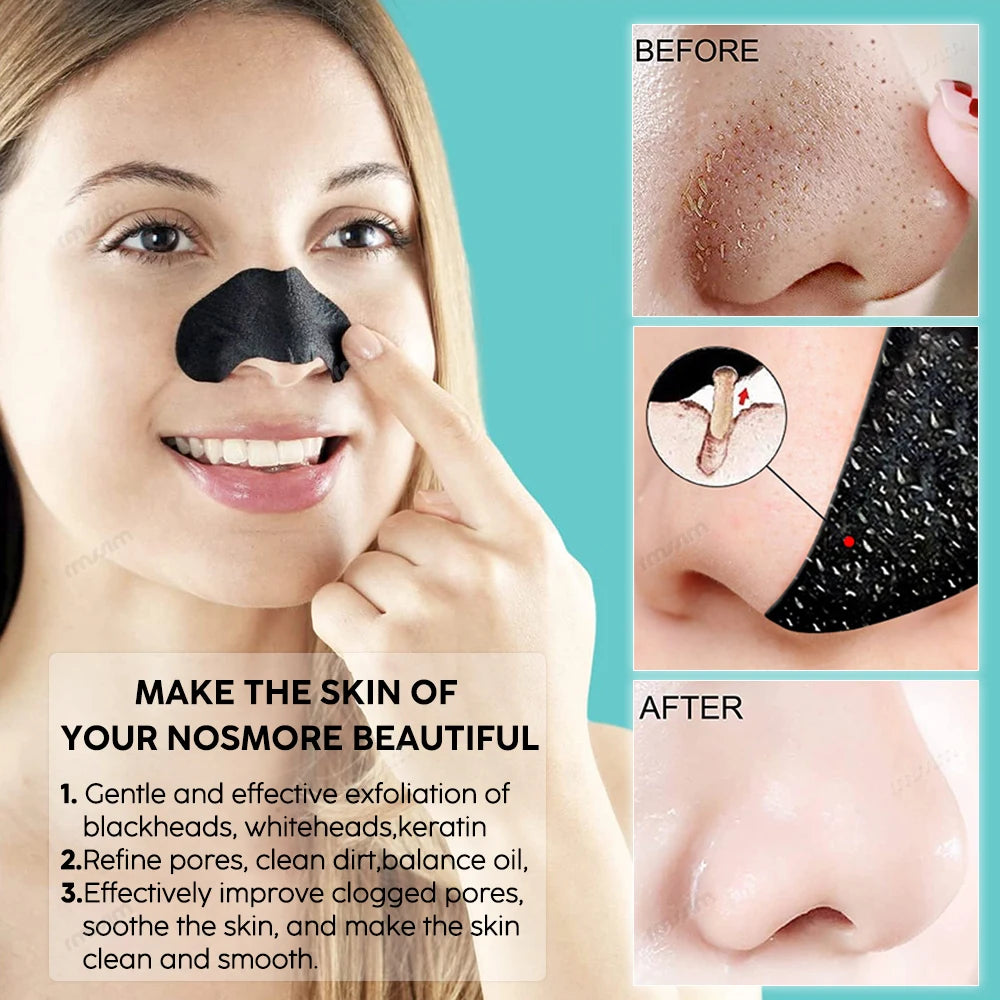 Blackhead Remover Nasal Strips