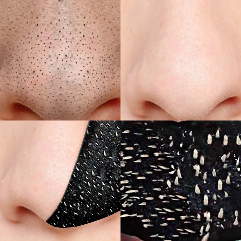 Blackhead Remover Nasal Strips