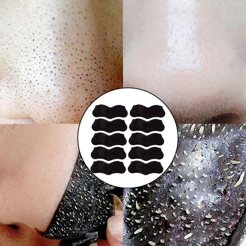 Blackhead Remover Nasal Strips